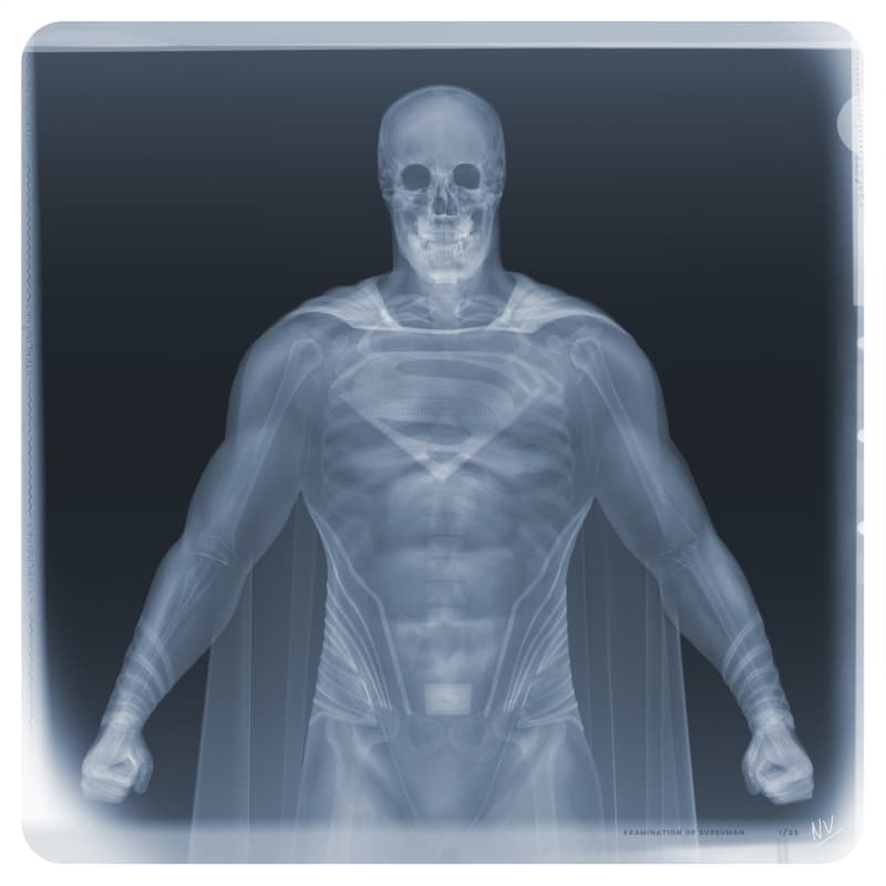 Nick Veasey, Examination of Superman, 2020