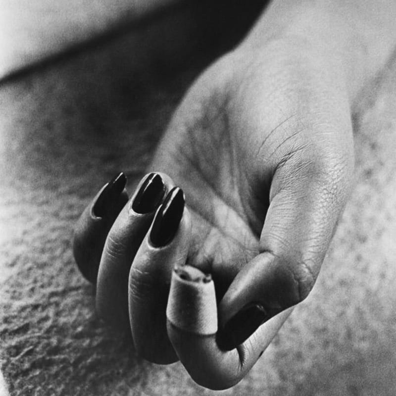 Daido Moriyama, Bandaged Finger, 1987