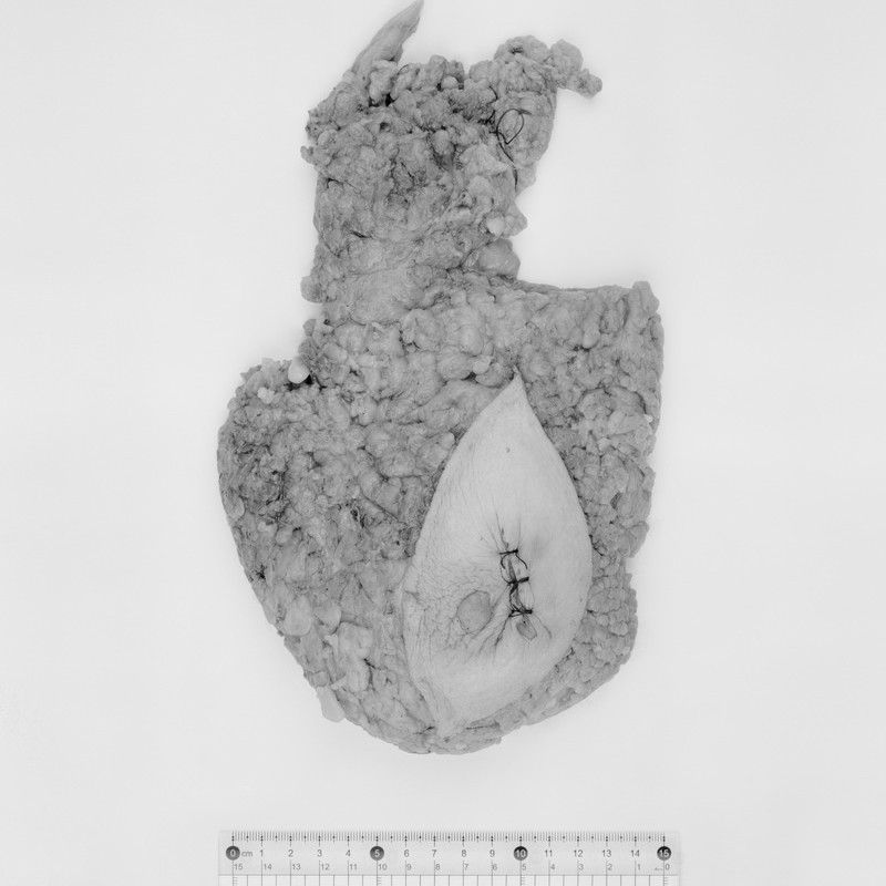 李朝晖 《大体：标尺下的器官09-胆囊》 Li Zhaohui SpecimenLHuman Organs Under a Ruler 09 - Gallbladder 2012 - 2013