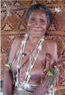 Botha Kimmikimmi (Hirokiki)