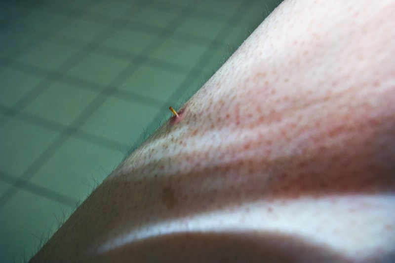 《身体/伤》 系列 Body/wound series 2008