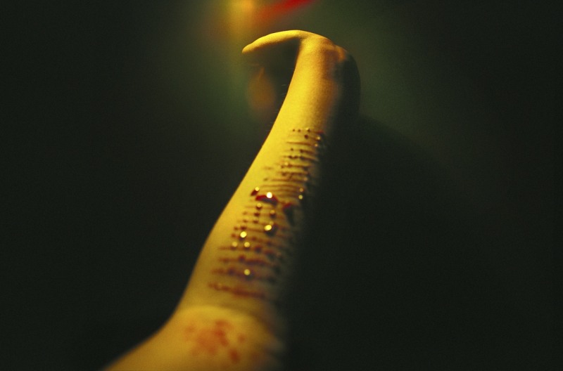 《身体/伤》 系列 Body/wound series 2008