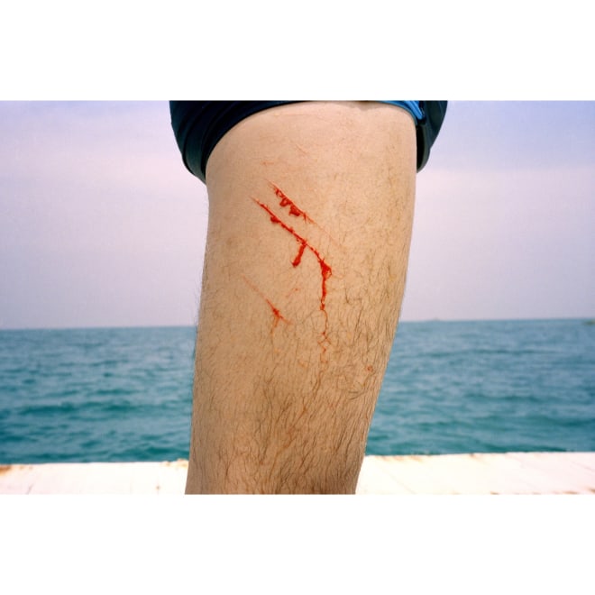 编号223，《血与伤》，2009，艺术微喷。  No.223, Bleeding, 2009, Photography with archival pigment print.